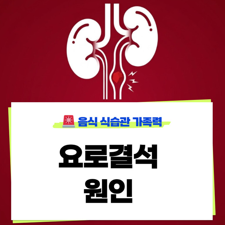 요로결석 원인 6가지 음식 가이드